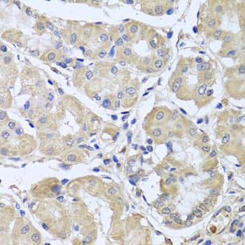 CEP57L1 Antibody