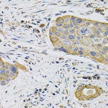 KRT20 / CK20 / Cytokeratin 20 Antibody