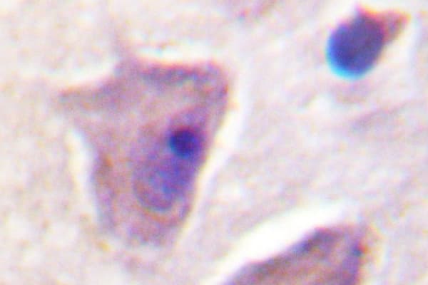 Polyclonal Rabbit anti-Human PTPN11 / SHP-2 / NS1 Antibody (Lys536, IHC, WB)