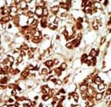 ZAK / MLTK Antibody (aa271-300)