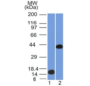 AMACR / P504S Antibody (clone AMACR/1864, Ready-to-Use)