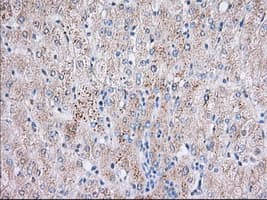Monoclonal Mouse anti-Human BTK Antibody (clone OTI10E10, IHC, IF, WB)