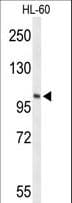 LIPE / HSL Antibody (aa822-849)