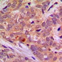 STK11 / LKB1 Antibody (C-Terminus)