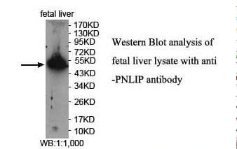 PNLIP / PL / Pancreatic Lipase Antibody (aa60-269)