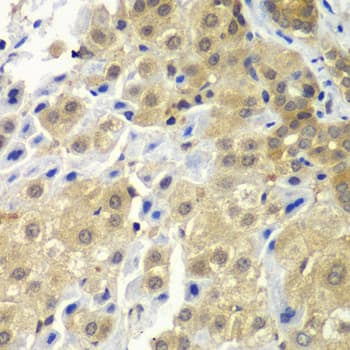 SGTA / SGT Antibody