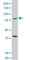 Monoclonal Mouse anti-Human BLIMP1 / PRDM1 Antibody (clone 2B10, WB)
