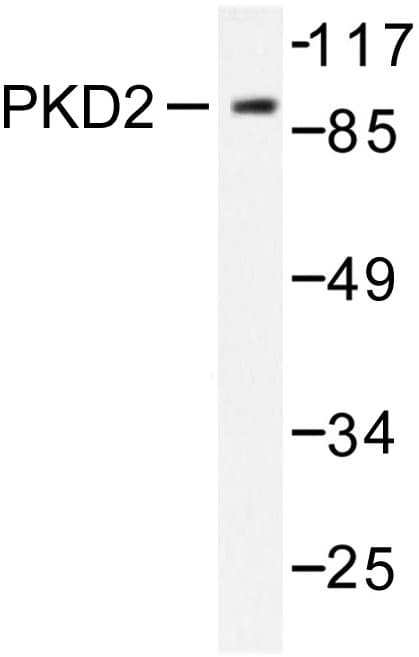 PRKD2 / PKD2 Antibody (Ala872)
