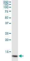 HBA1+2 / Hemoglobin Alpha Antibody (clone 4F9)