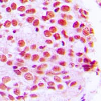 ERF / PE2 Antibody (C-Terminus)