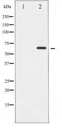 Polyclonal Rabbit anti-Human CCNB1 / Cyclin B1 Antibody (IHC, IF, WB)