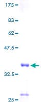 Human HIN-1 / SCGB3A1 Protein (Recombinant GST)
