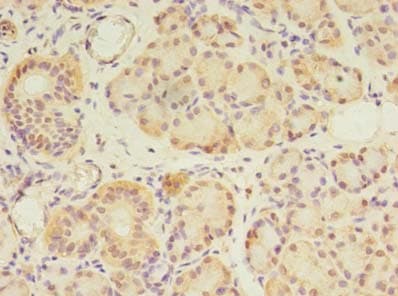 Polyclonal Rabbit anti-Human GPC4 / Glypican 4 Antibody (IHC, WB)