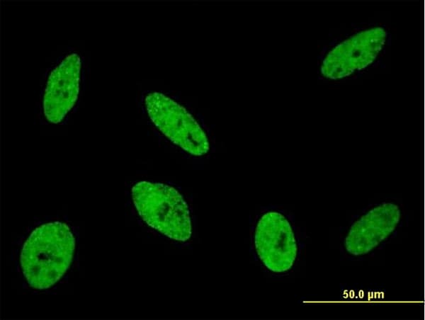 IHC-plus™ Monoclonal Mouse anti-Human CDKL1 Antibody (clone 5B11, IHC, IF, WB)