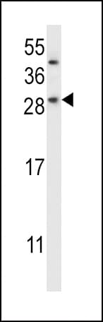 CHMP2B Antibody (aa1-30)