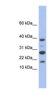 KFYI / NDUFC1 Antibody (C-Terminus)