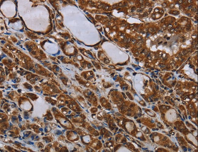 MT-ND1 Antibody