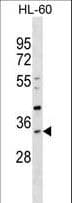 Polyclonal Rabbit anti-Human SULT1B1 / Sulfotransferase 1B1 Antibody (aa191-219, WB)