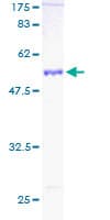 Human PSMA4 Protein (Recombinant GST)
