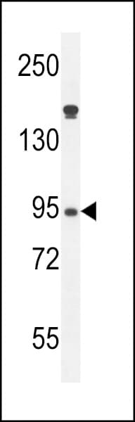 Polyclonal Rabbit anti-Human MPO / Myeloperoxidase Antibody (aa60-89, WB)