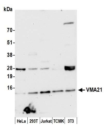 VMA21 / XMEA Antibody (aa51-101)