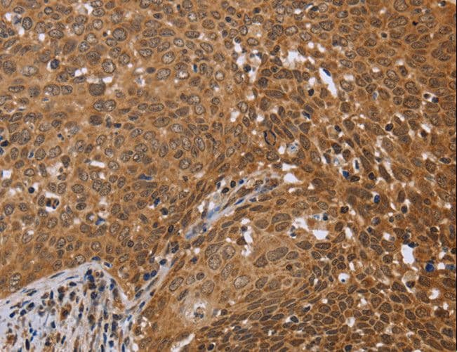 Polyclonal Rabbit anti-Human FKBP38 / FKBP8 Antibody (IHC, WB)