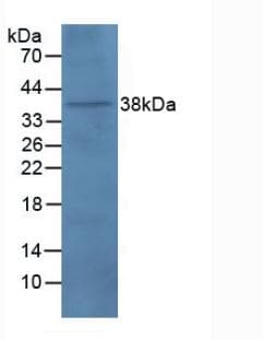 PNMA2 / MA2 Antibody (aa74-333)