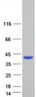 Human DPH5 Protein (Recombinant Myc-DDK (Flag))