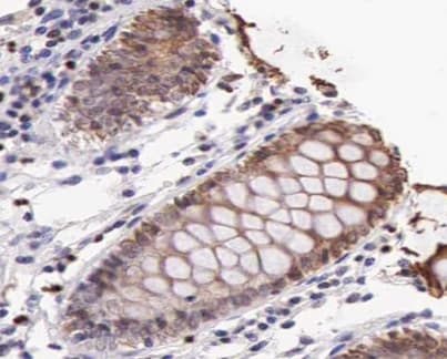 HSPA9 / Mortalin / GRP75 Antibody