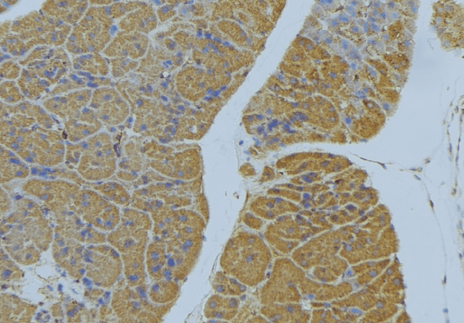 NRP2 / Neuropilin 2 Antibody