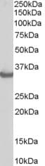 IHC-plus™ STUB1 / CHIP Antibody (aa219-231)