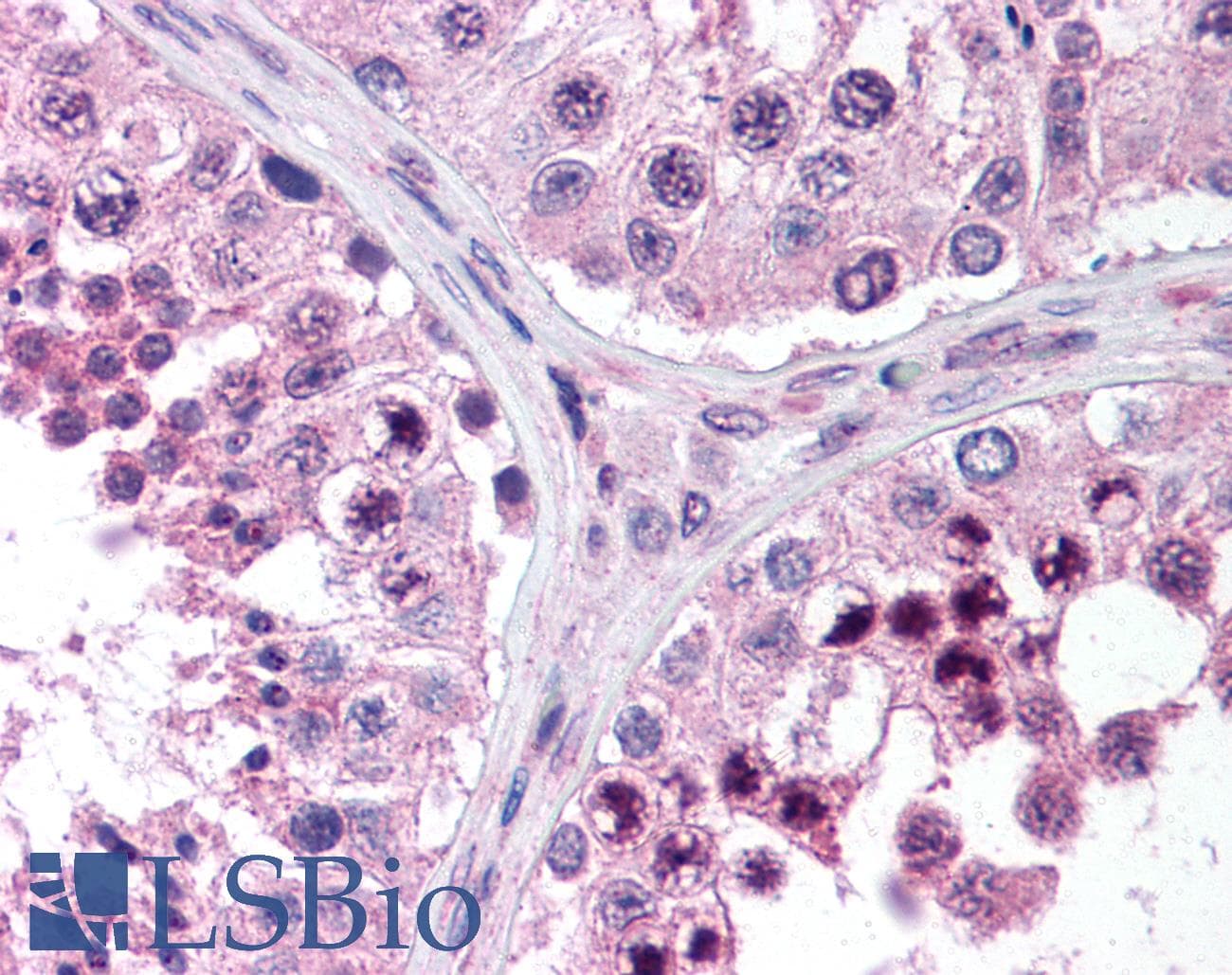 SYCP3 / SCP3 Antibody (C-Terminus, Biotin)