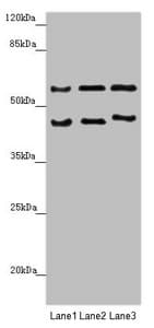 RBM17 Antibody