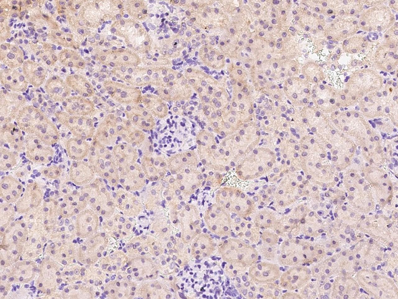 Polyclonal Rabbit anti-Rat ANPEP / CD13 Antibody (Preservative Free, IHC)