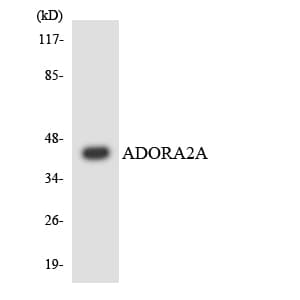 Polyclonal Rabbit anti-Human ADORA2A/Adenosine A2A Receptor Antibody (aa109-158, IHC, WB)