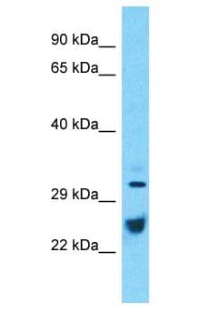 ATP1B1 Antibody (aa253-302)