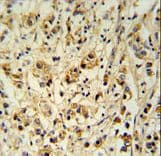 Polyclonal Rabbit anti-Human SMAGP Antibody (aa46-75, IHC, WB)
