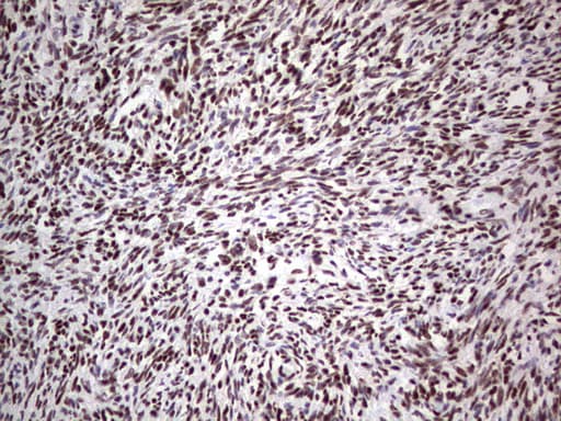 Monoclonal Mouse anti-Human C14orf166 Antibody (clone OTI4A3, IHC, WB)
