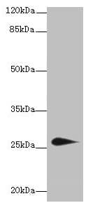 Polyclonal Rabbit anti-Human TMEM174 Antibody (IHC, WB)