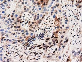 SQSTM1 Antibody (clone OTI4G9)