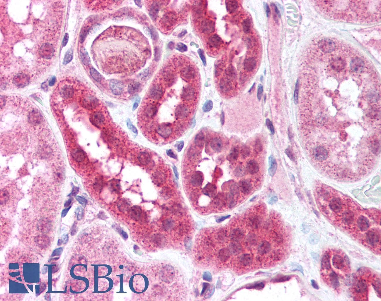 IHC-plus™ DCLRE1C / Artemis Antibody (aa677-692)