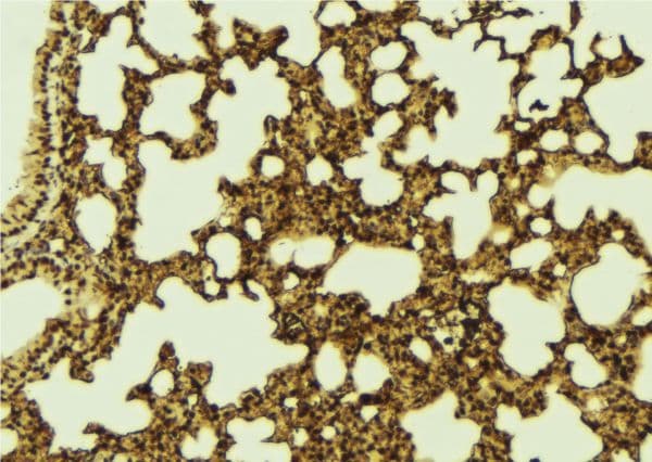 Polyclonal Rabbit anti-Human PHF19 Antibody (IHC, WB)