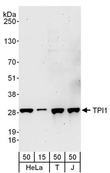 IHC-plus™ TPI1 / TPI Antibody (aa1-50)