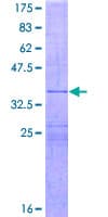 Human IL26 Protein (Recombinant GST, N-terminus)
