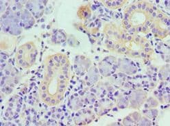 Polyclonal Rabbit anti-Human TNFSF13 / APRIL Antibody (aa105-247, IHC)