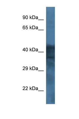 Polyclonal Rabbit anti-Human GABRB1 Antibody (aa214-263, WB)