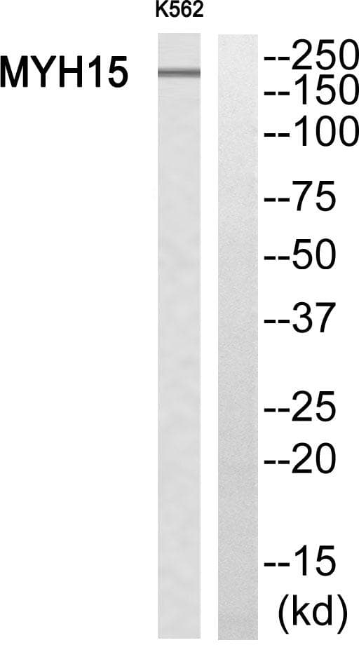 Polyclonal Rabbit anti-Human MYH15 Antibody (WB)