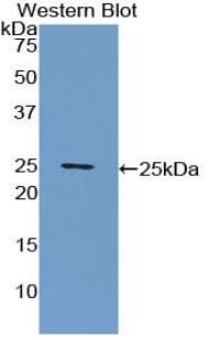 CRP / C-Reactive Protein Antibody (aa20-222, APC)