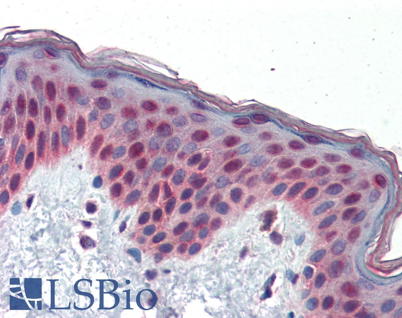 TCF7L1 / TCF-3 Antibody (aa35-84)