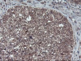HDHD1 Antibody (clone OTI7A2)